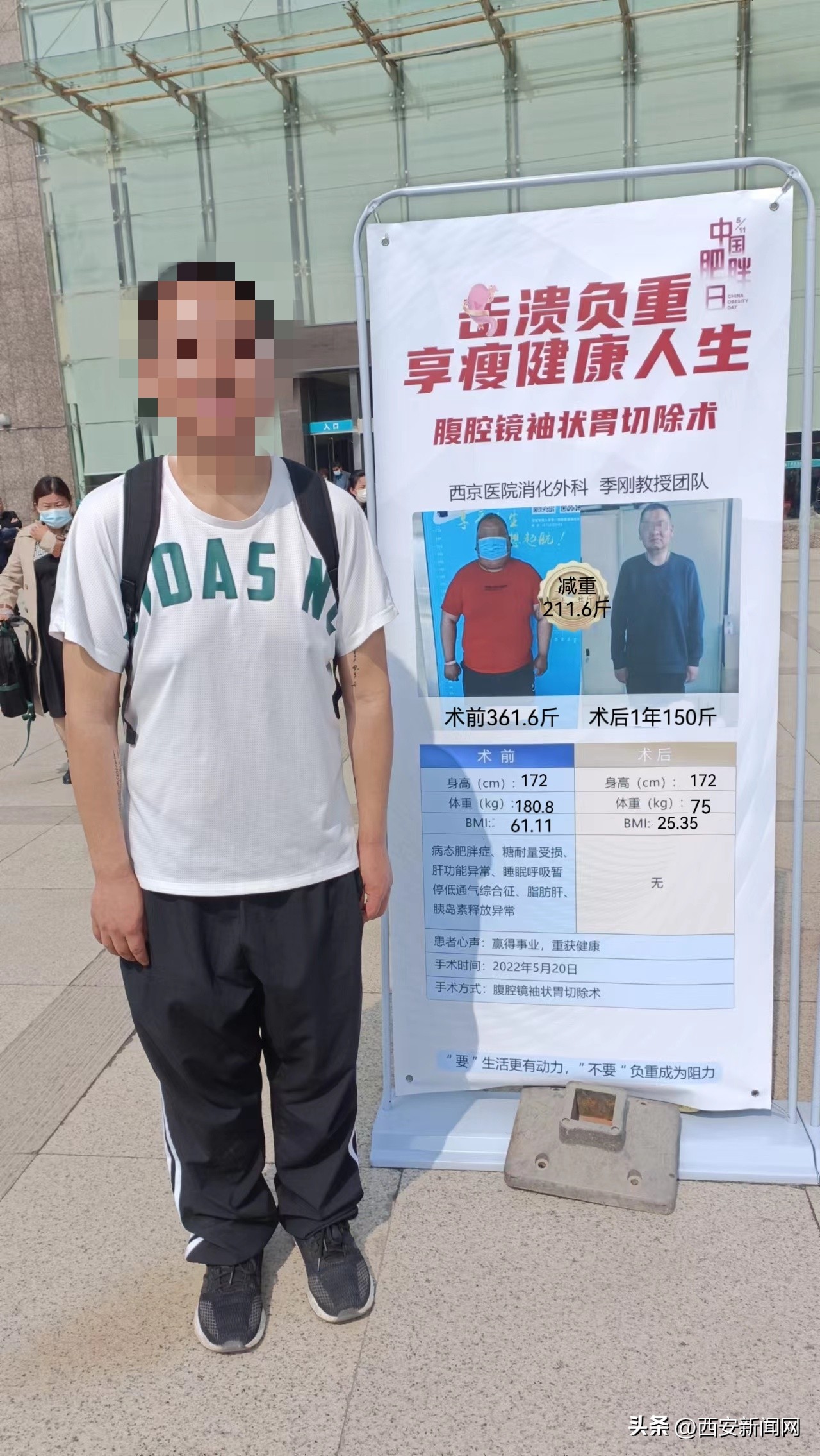 一个月健康减重20斤的方法,减重手术后两个月瘦36斤