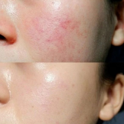 孕期补水水乳品牌排行,秋冬孕妇水乳推荐测评排行榜