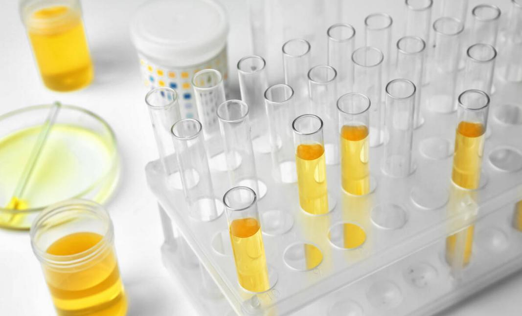 吃降压药十几年了会伤肾吗,降压药吃多了伤肾吗