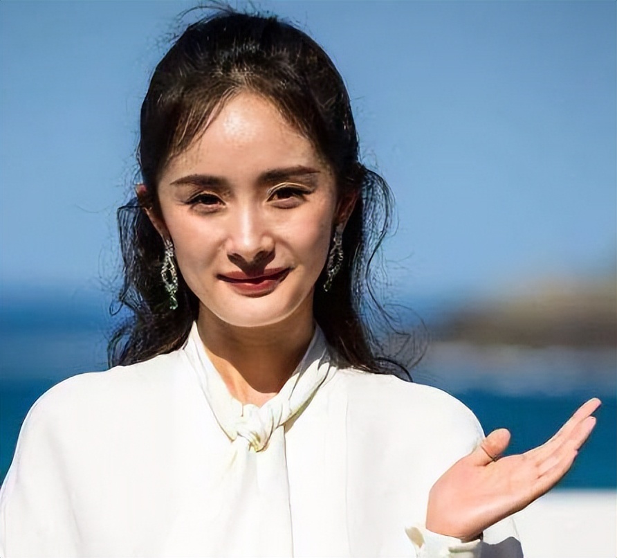 哪些明星整容后遗症越来越严重,整容明星后遗症对比图片