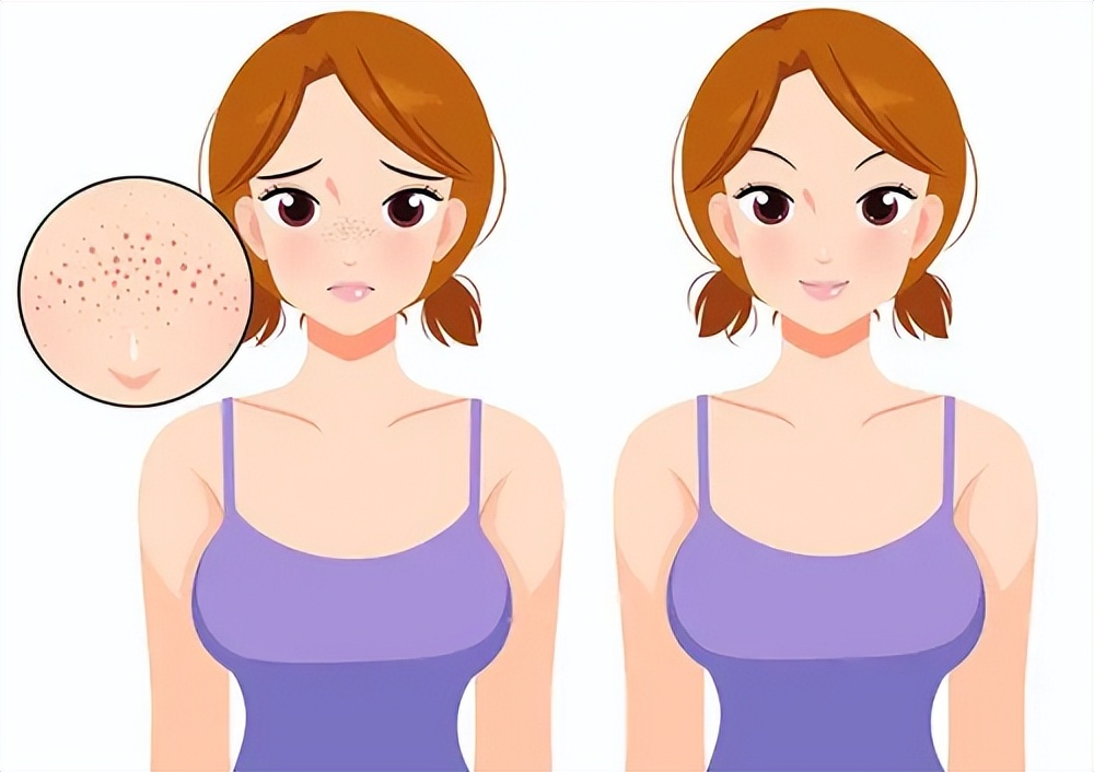 如何可以真正的解决毛孔问题,不同肤质该怎样清洁毛孔