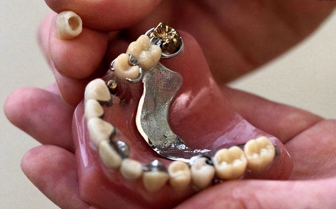 干货分享口腔,全口义齿是怎样做的