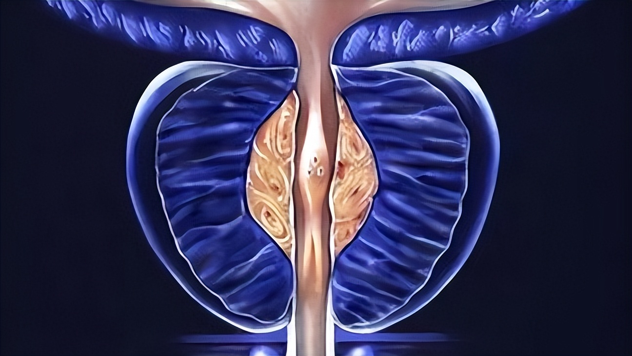 网上说前列腺治愈的都是骗人的吗,网上广告治疗前列腺可信吗