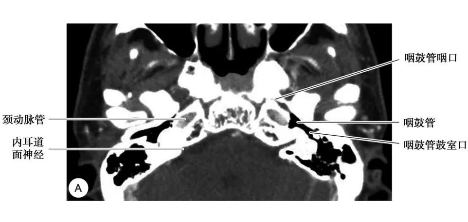 耳部解剖结构和生理功能,耳部解剖笔记