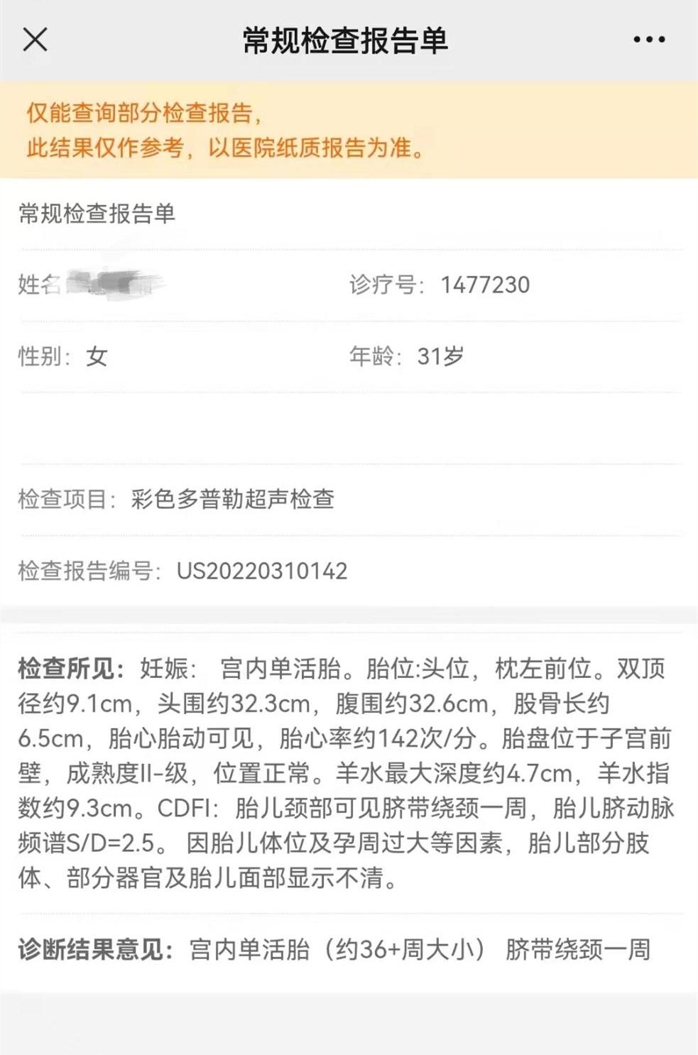 看到宝宝感动的瞬间,看到宝宝的那一刻所有的痛都值了