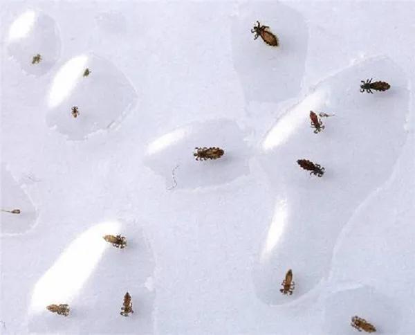 小时候头上长虱子的事,小时候头上的虱子是什么样子的