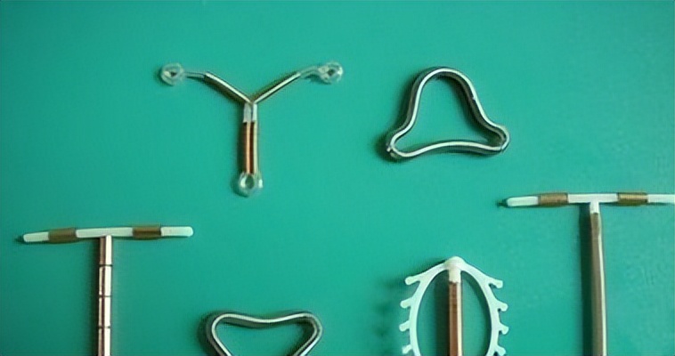 以前上环的女性30多年后现状如何,我国第一批上环的女性现在怎么样