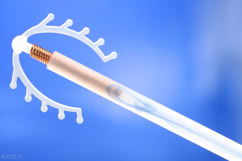 女性上环的全过程，过程让人胆寒，别害羞，男女都该好好看看！