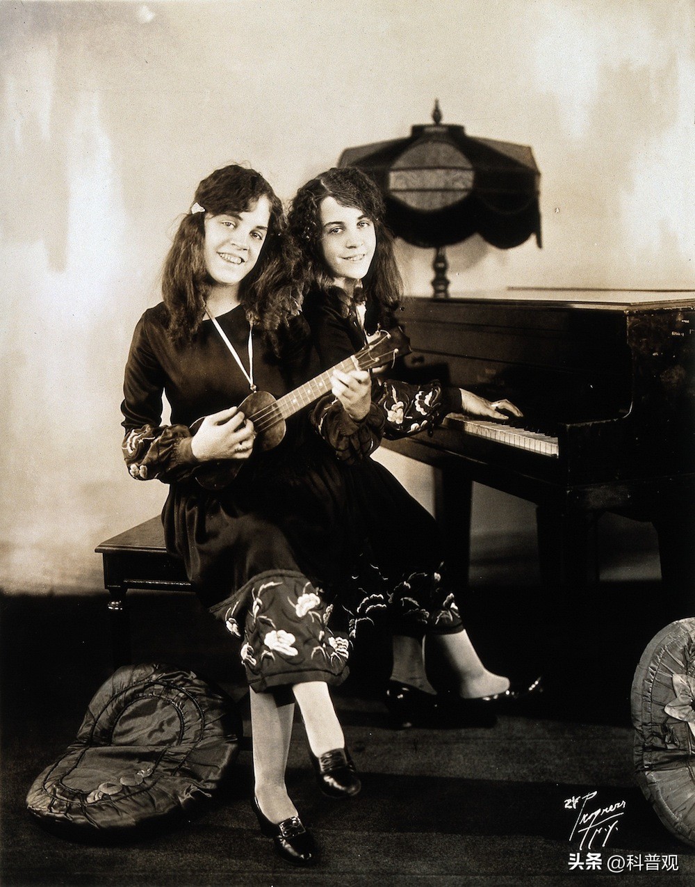 连体人一方死亡怎么办？妹妹去世后，连体姐姐被迫跟遗骸共同生活