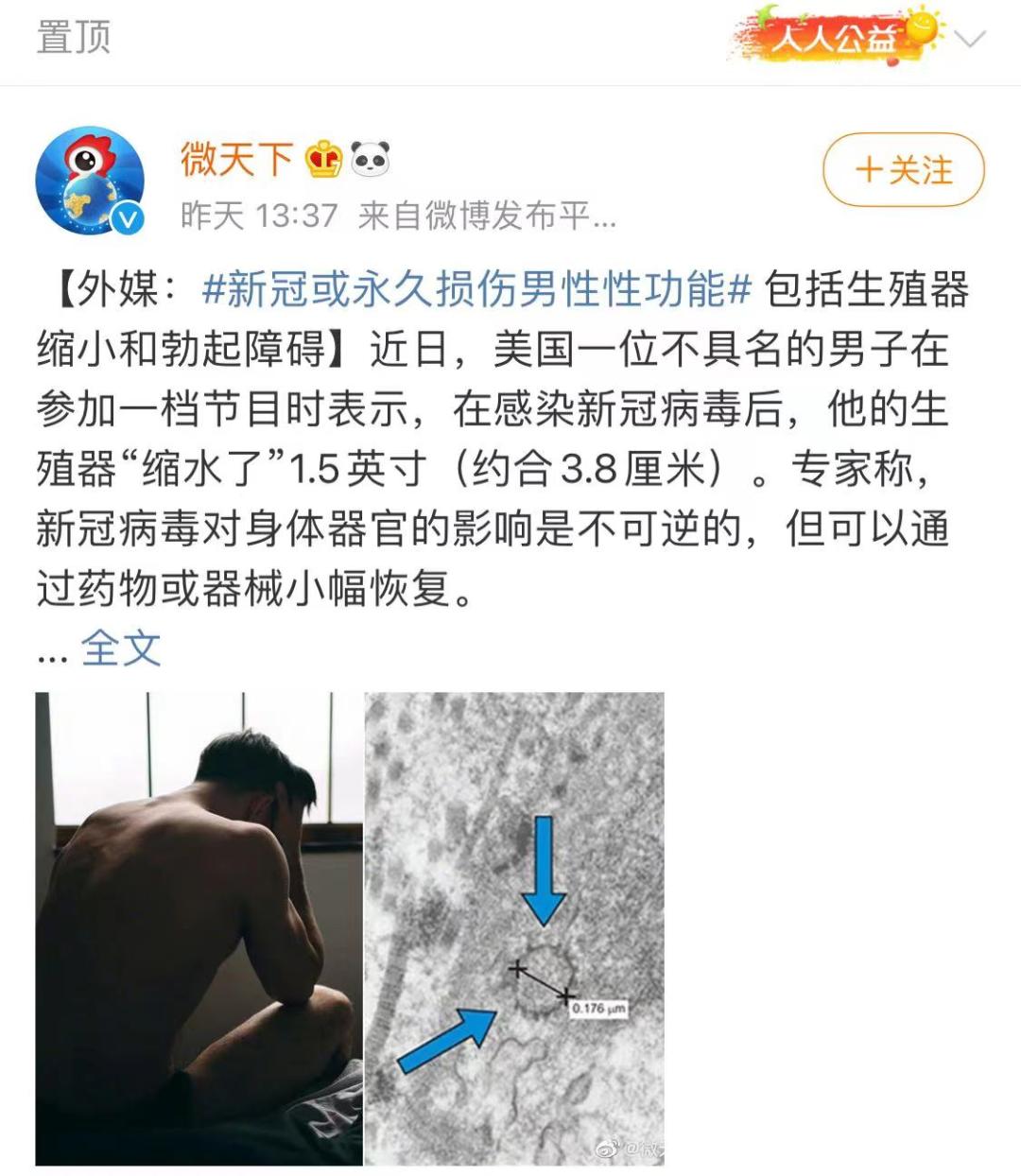 男人“阳了”后,性功能会受影响吗?有人感染后丁丁缩水3.8cm?