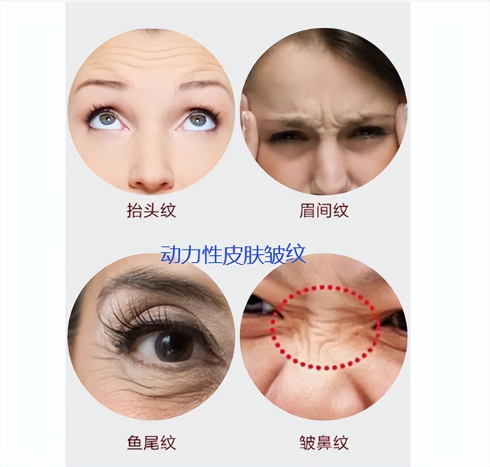 同样是打针为什么区别这么大,打除皱针的效果对比照