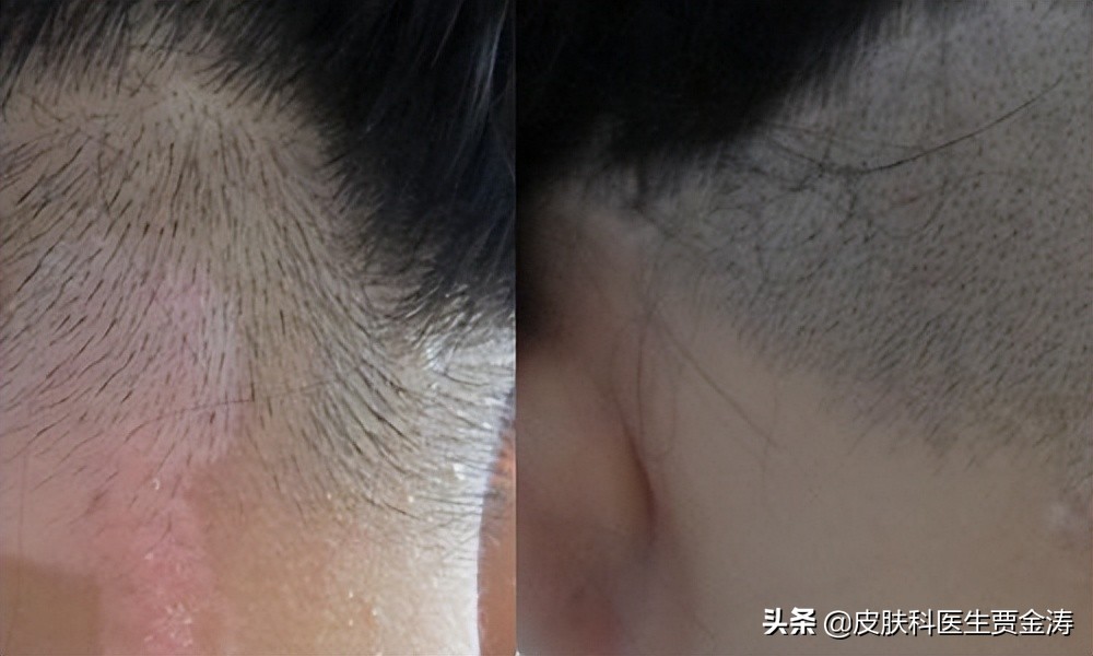 中医治疗白癜风最好的医院,倪海厦中医治疗白癜风