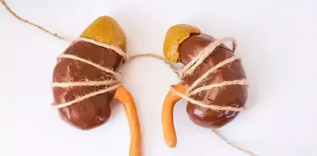 肾结石不能吃鸡蛋吗需要注意什么,肾结石鸡蛋不能吃还能吃什么