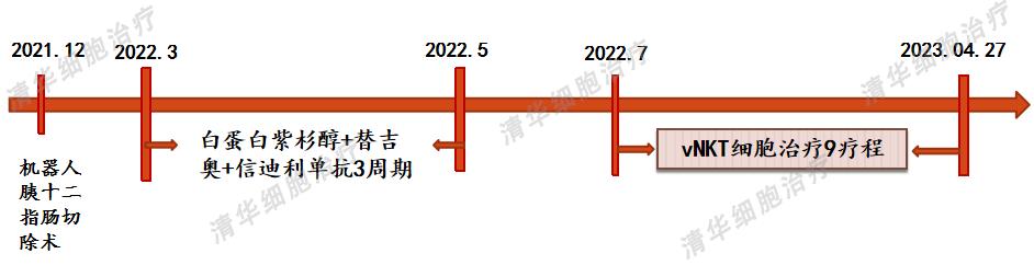 胰腺癌复发率高、预后差，联合细胞治疗提升生存期