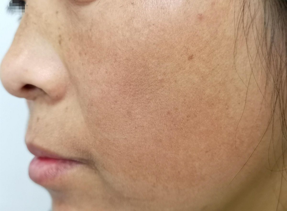 好习惯可以去白发老年斑,预防老年斑应养成的7个好习惯