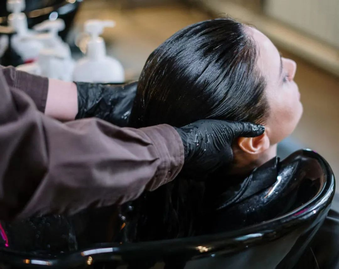 冬天头皮屑多又痒怎么回事,为啥一到冬天头皮屑多还痒