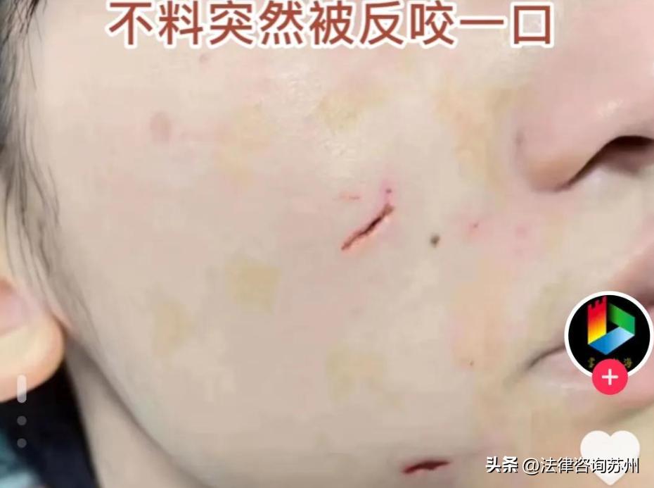 大狗咬伤小狗要赔偿八千元合理吗,宠物狗被咬伤索赔的案例