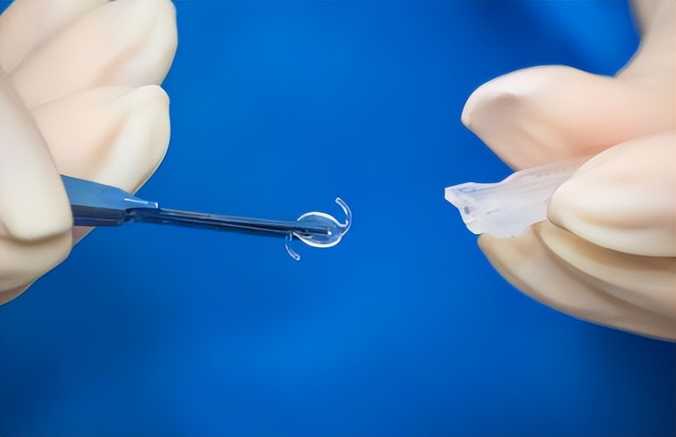 近视眼做飞秒激光有什么后遗症,用激光治近视眼