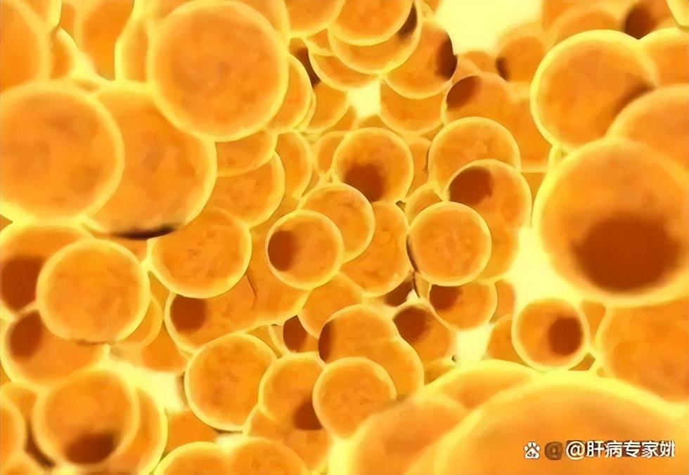 中医上与肝有关的疾病有哪些,治肝病哪种中成药不伤肝