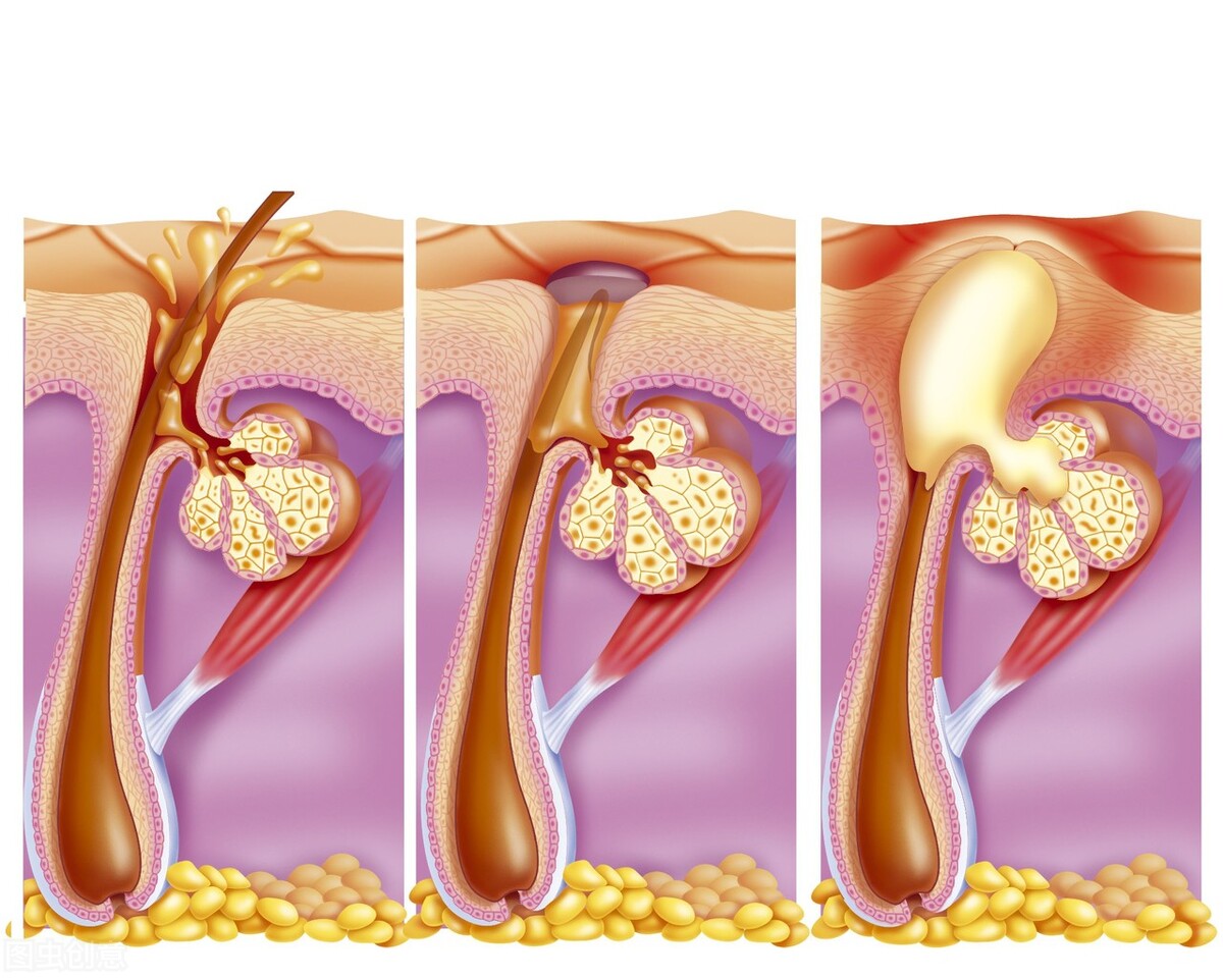 半夜皮肤瘙痒是什么原因引起,夜半全身发痒