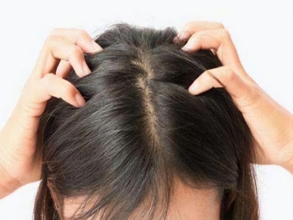 神经性皮炎喝过中药后为啥更痒,手越抓越痒是皮炎还是真菌感染