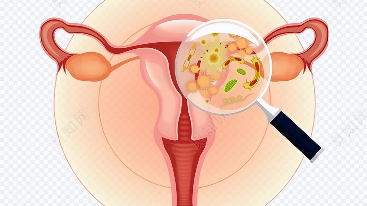 一个女人没有子宫会怎样？和正常女性有什么不同？能有夫妻生活吗