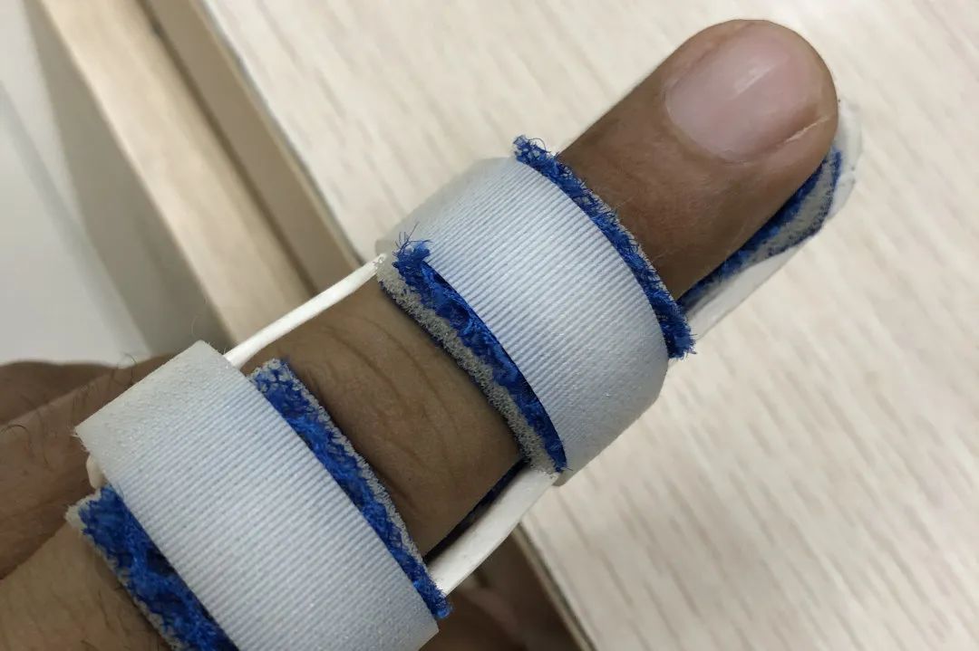 我为打蚊子站上凳子，结果两颗门牙说了拜拜