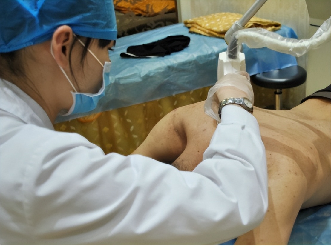 脖子上长小肉疙瘩丝状疣怎么治疗,脖子上长小肉疣怎么治疗