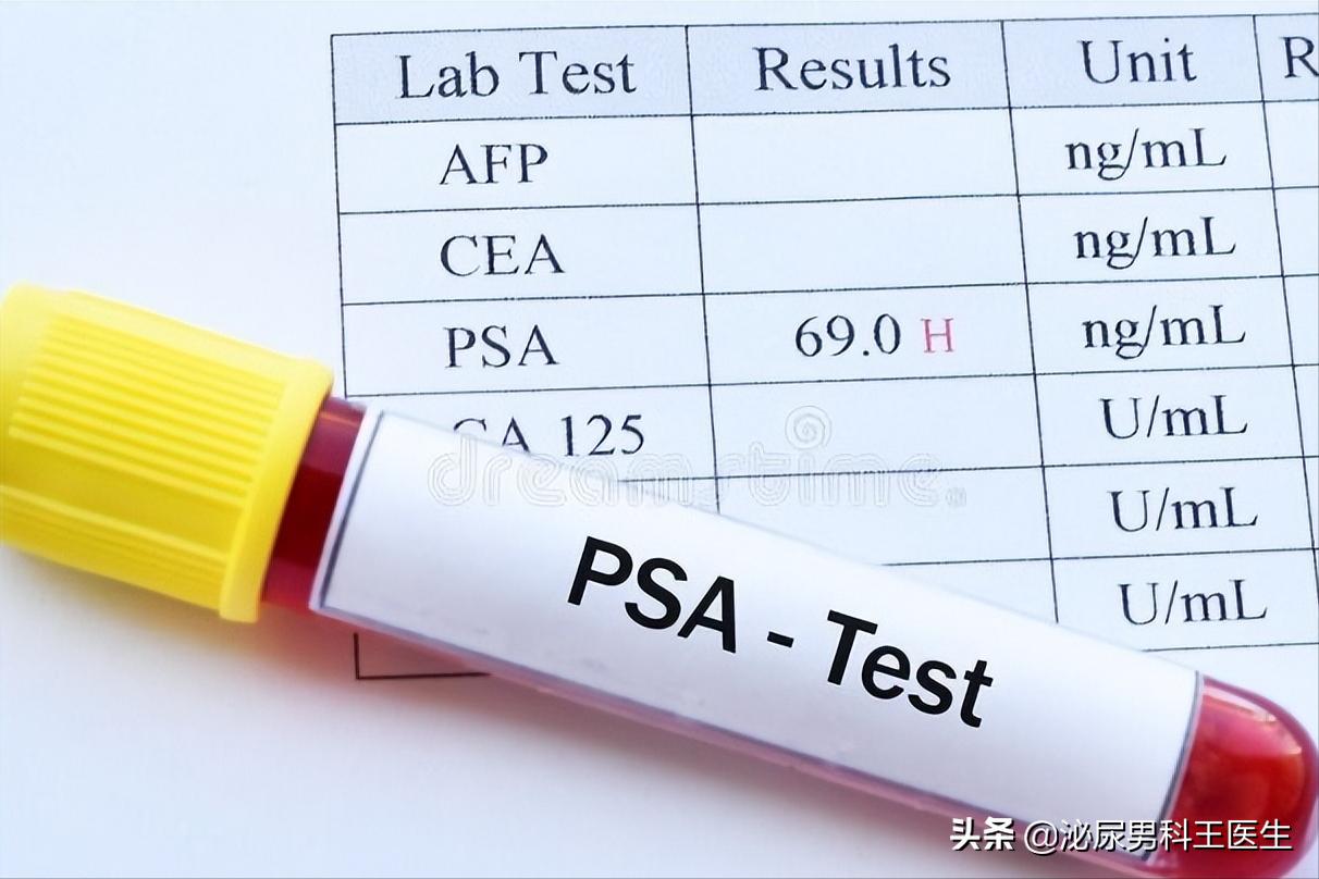 前列腺癌发现就是晚期？叶定伟教授：50岁以上最好每年检查一次