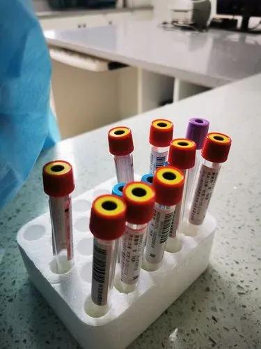 陕西发现棕色熊猫,陕西发现“黄金血”血型