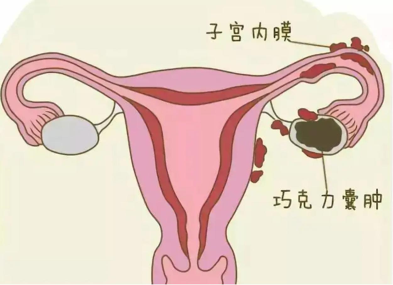 7cm巧囊不用做手术！一剂中医古方补肾祛瘀，消散囊肿有良效