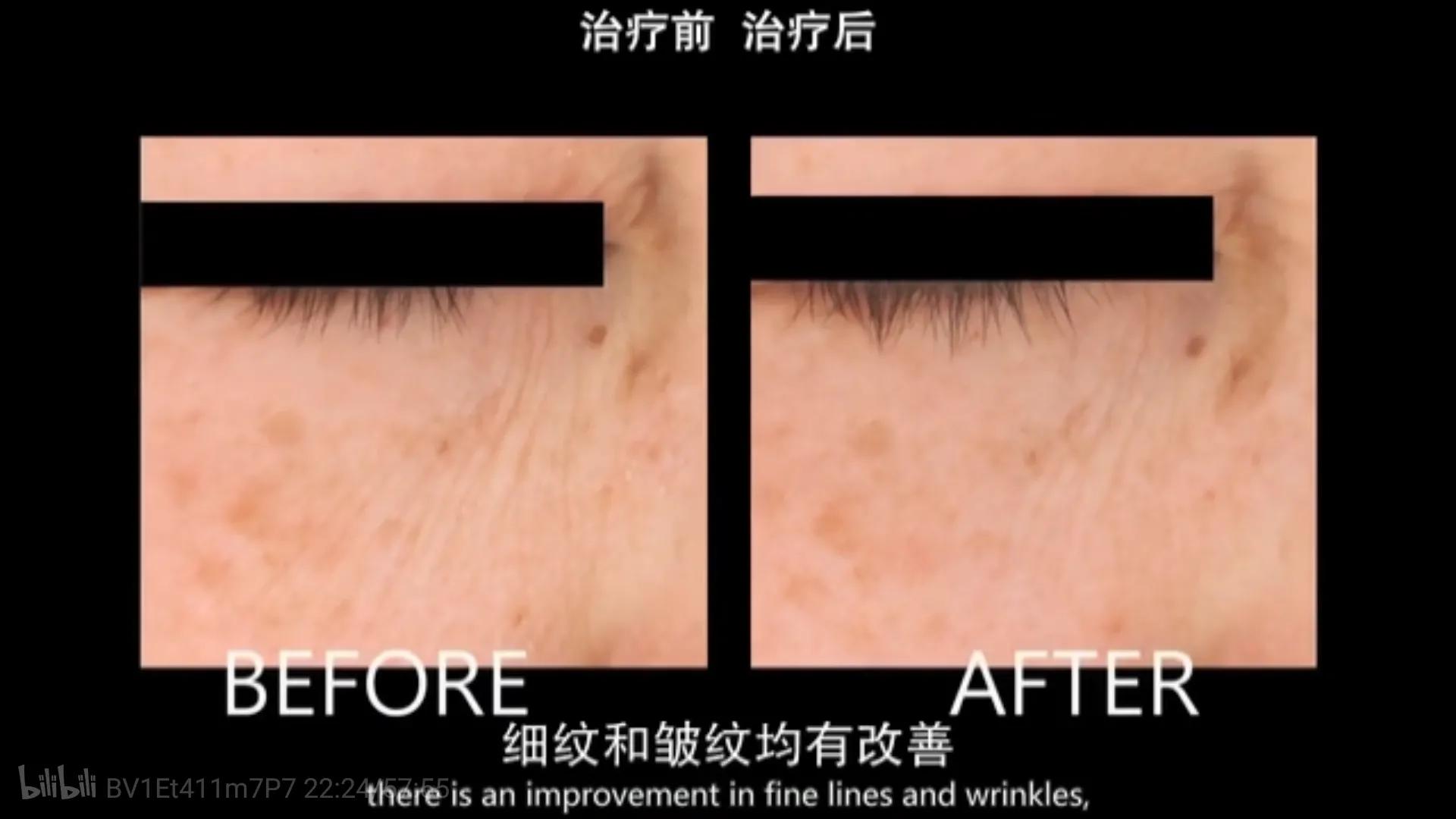 看完美容的真相我哭了,美容的真相纪录片