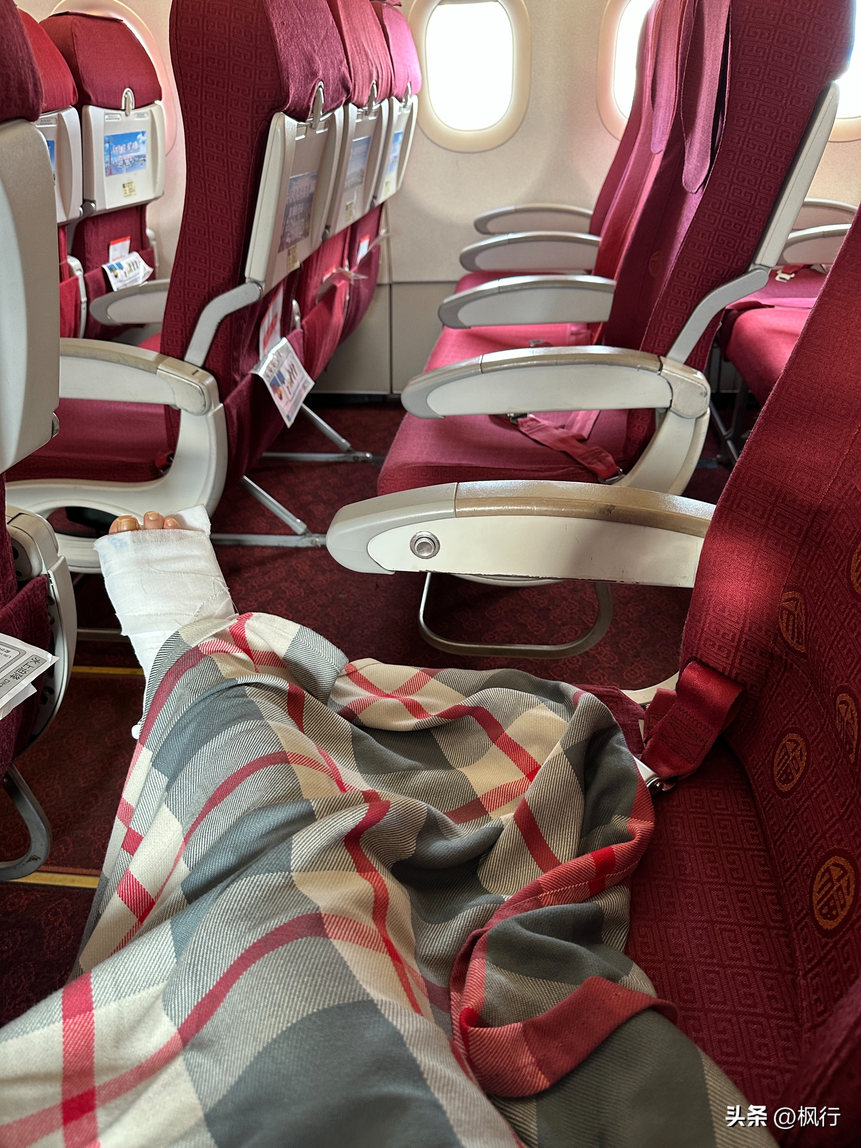 旅游期间发生意外怎么处理,旅游遇到意外伤害如何处理