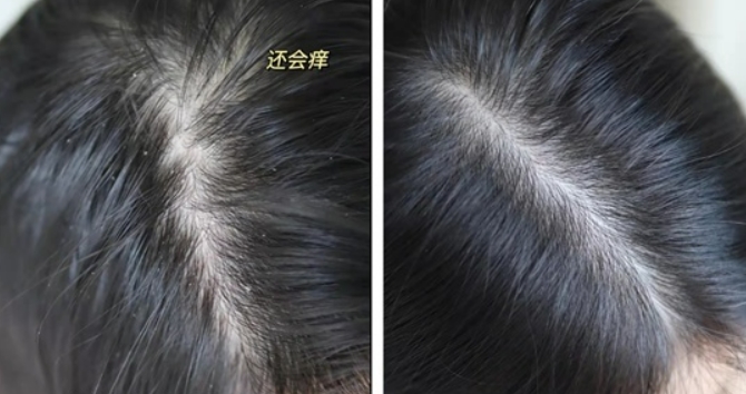 蜂花洗发水哪款好用又安全,哪款蜂花洗发水不含硅油成分