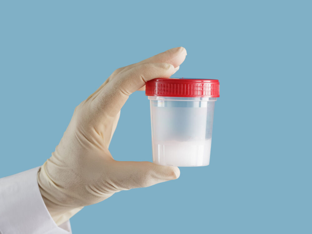 精子不液化是否会影响怀孕,精子不液化能影响怀孕吗