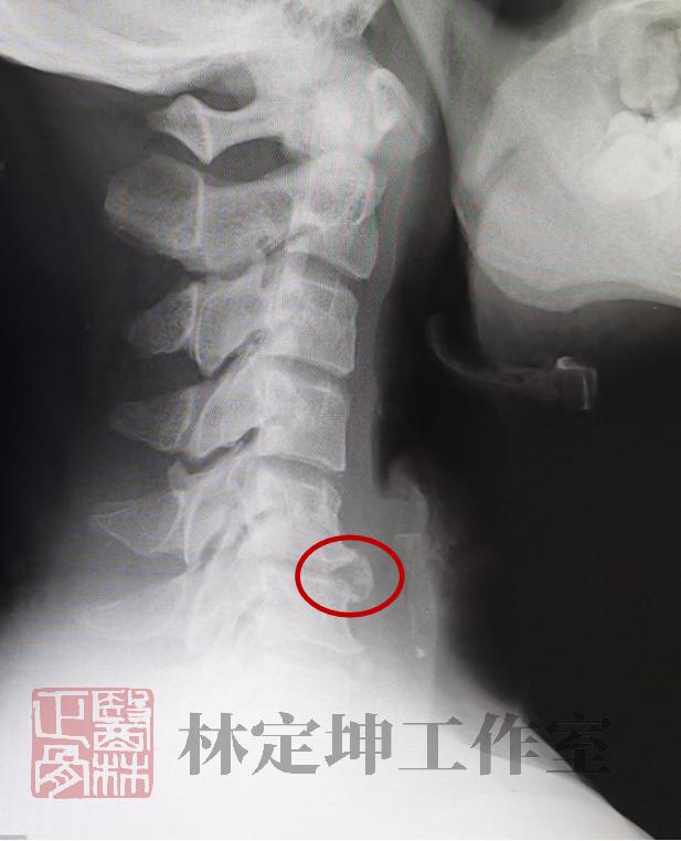 骨科的三大谣言你都知道吗,医林正骨