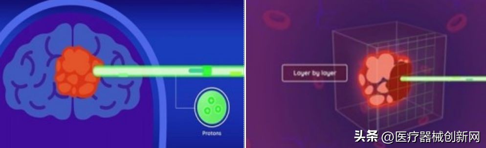 全球最新质子治疗系统,国产小型质子治疗系统项目已完成