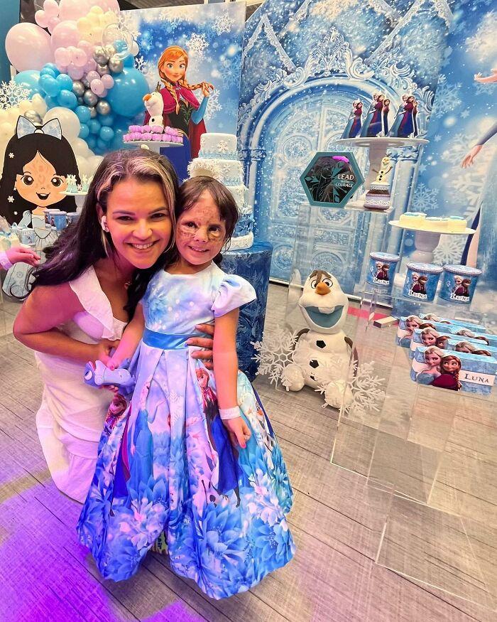 美国小女孩脸带“蝙蝠侠”黑印，治疗两年经过终于恢复肉色！