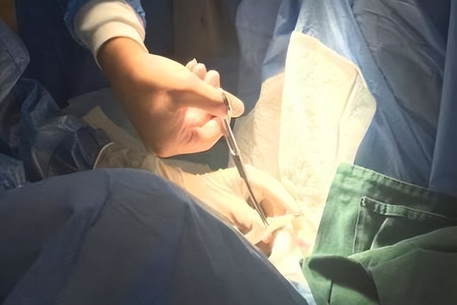 结扎的女性卵子怎么排出来的,女性结扎之后卵子如何排出