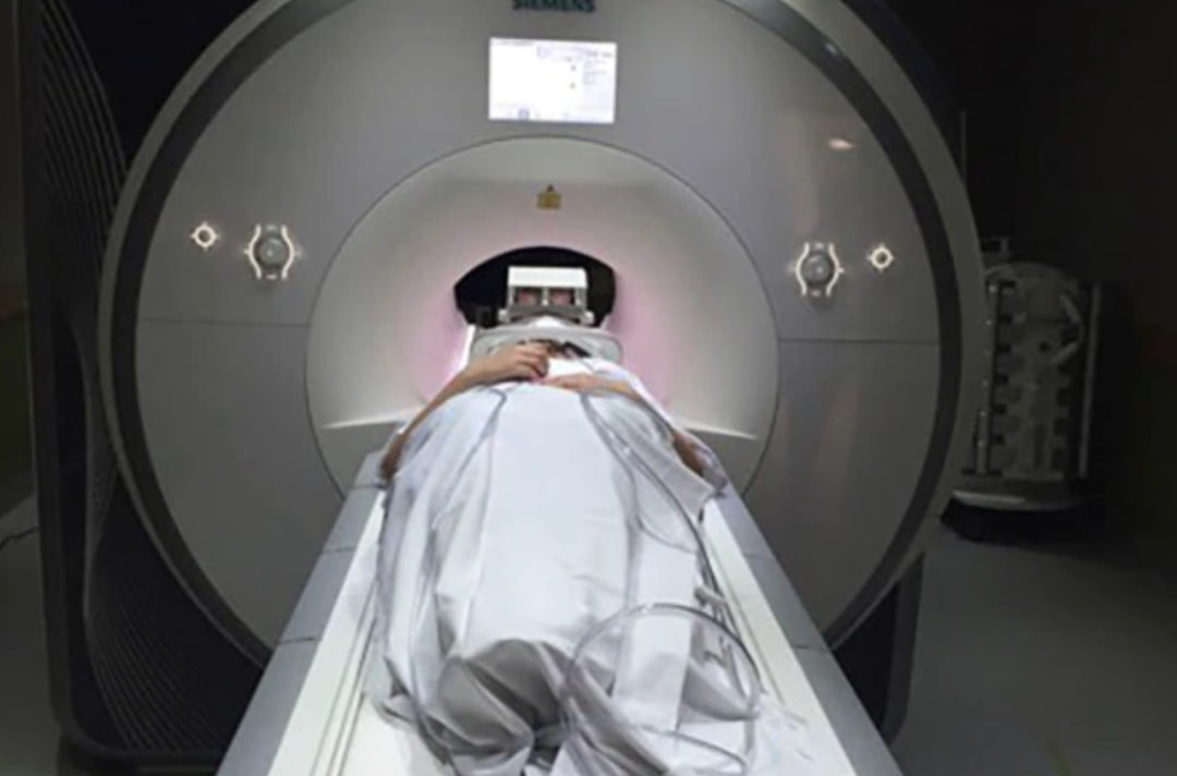 澳大利亚首例新冠病人,首例新型冠状病毒感染者