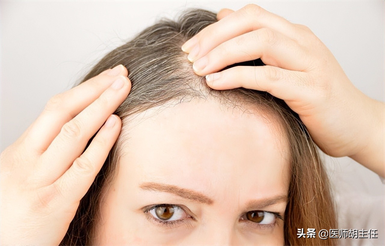 白头发增多是缺乏什么营养,白头发增多是缺少什么营养素吗