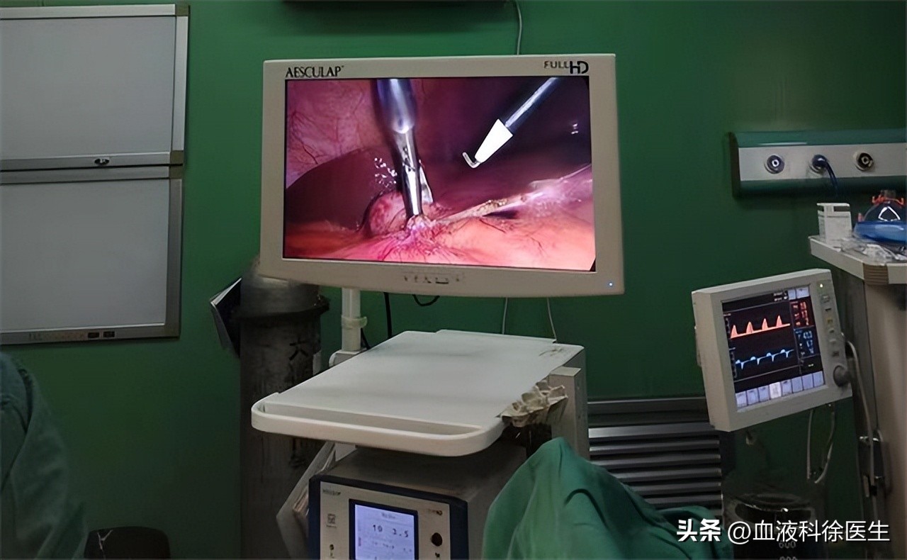 胆囊切除后遗症有哪些,胆囊切除都有哪些后遗症