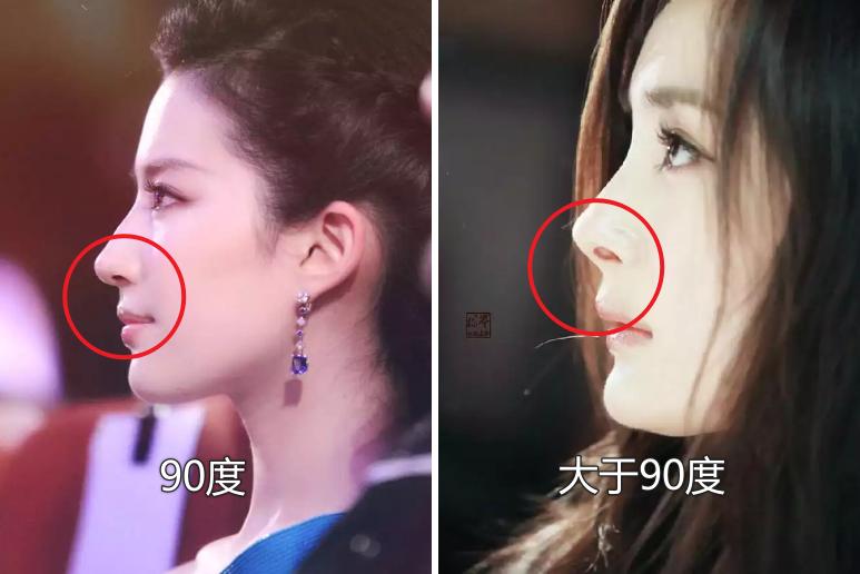 鼻子塌山根低鼻孔外露没福气吗,鼻子塌而且不露鼻孔