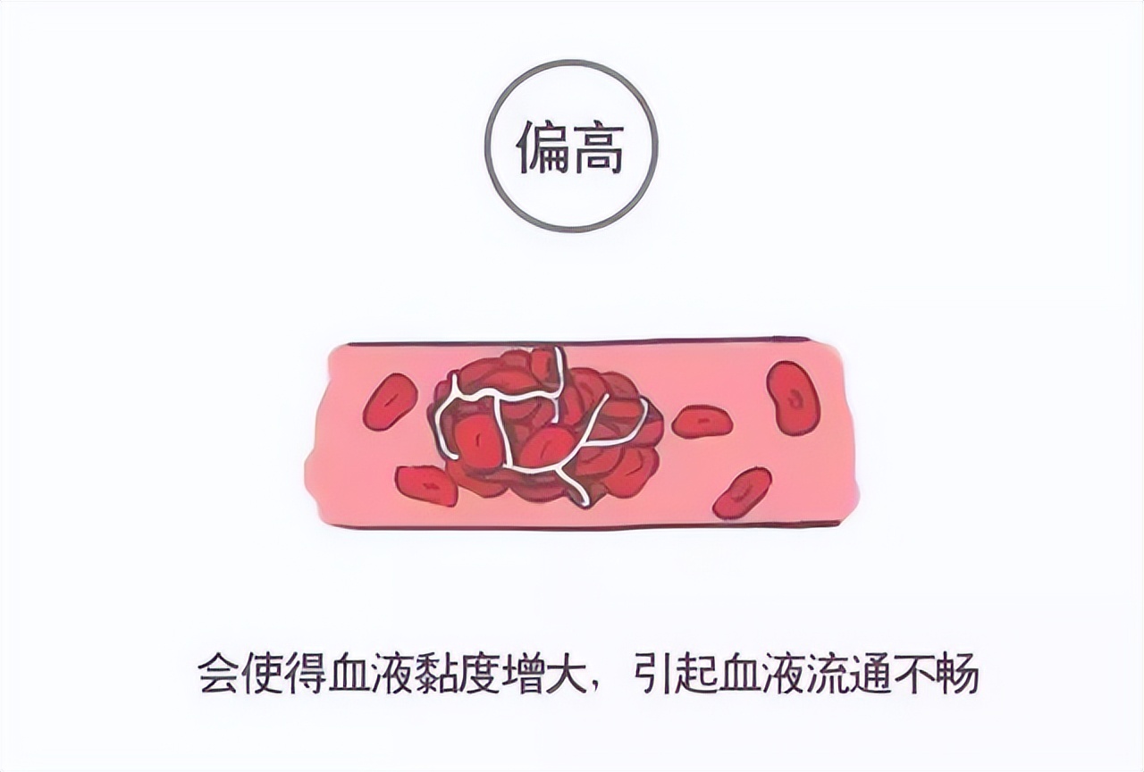 看懂体检报告单箭头的意思,体检报告单上米符号是什么意思