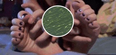 一走路脚趾甲痛,甲沟炎拔完脚趾甲很疼怎么办