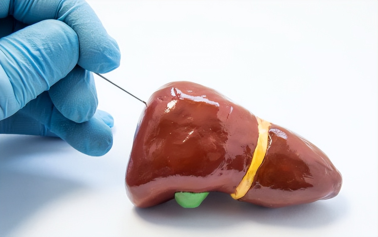 谷草转氨酶和谷丙转氨酶高怎么降,谷丙转氨酶谷草转氨酶高要查什么