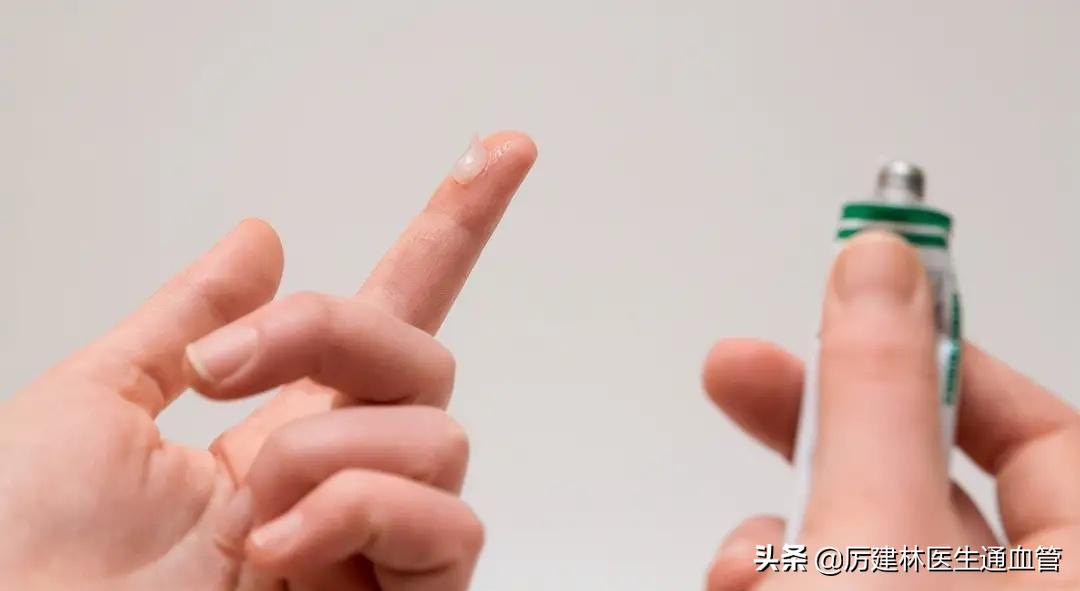 红霉素眼膏和红霉素软膏区别在哪,红霉素软膏和红霉素眼膏有啥区别