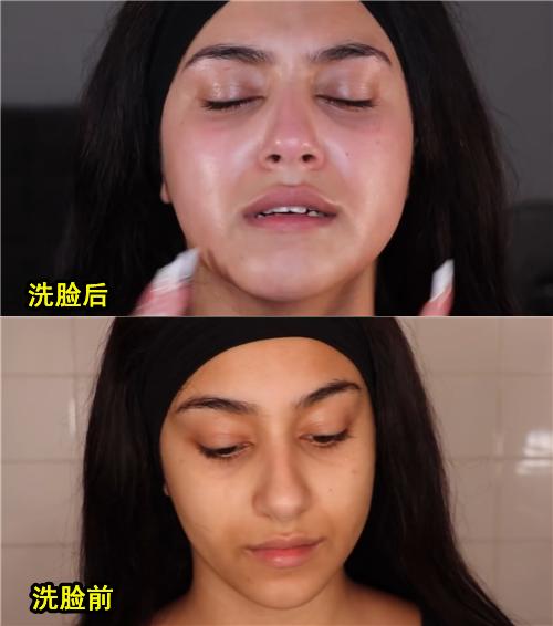 对水过敏的人怎么喝水,怎么会对水过敏