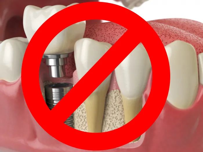 什么样的可乐牙需要治疗,健康科普温馨提示信息