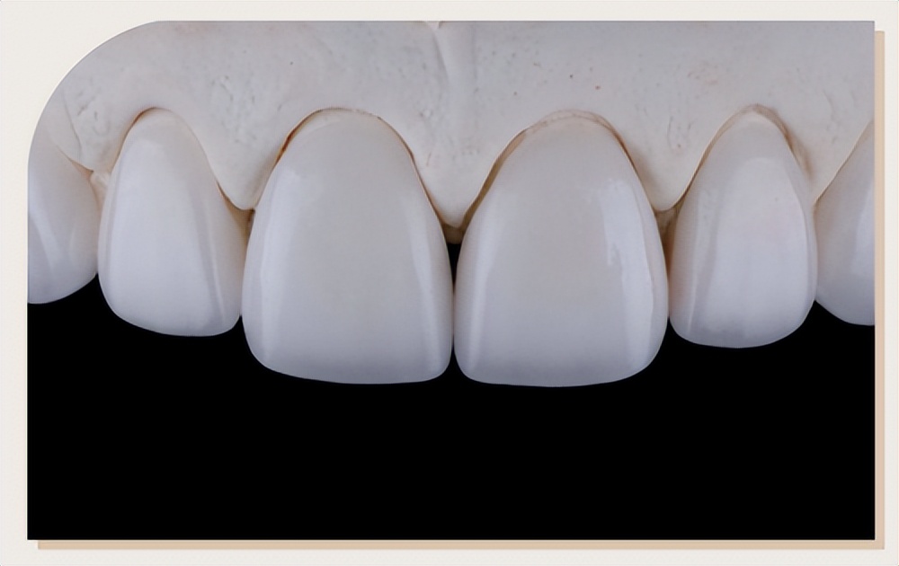 你需不需要做美牙，美伦美咖：这个问题该问谁？